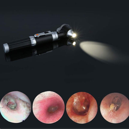 Ear Otoscope