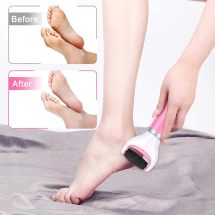 Electric Foot File Dead Skin Callus Remover Grinder Foot Care Pedicure Tool 9_35815a77-d25a-47d6-a40e-1f60ec2a1278