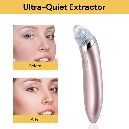 Electric Blackhead Suction Remover