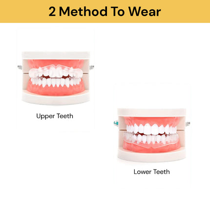 Anti Teeth-Grinding Dental Guard