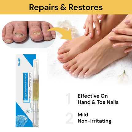 Nail Fungal Treatment Solution