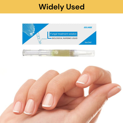 Nail Fungal Treatment Solution