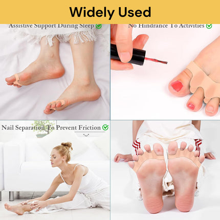 Pair Of Toe Straightener