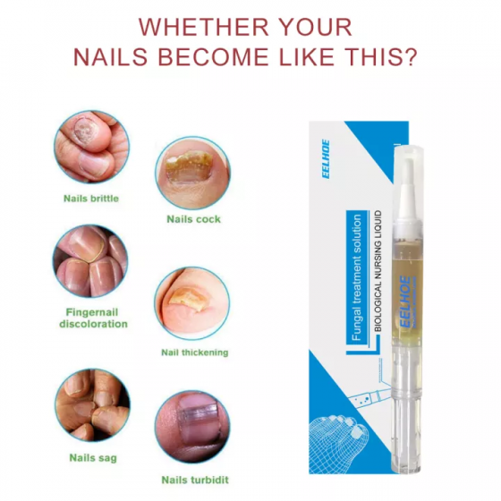 Nail Fungal Treatment Anti Fungus Biological Nail Repair Solution Fingernail Treatment Toenail Treatment 2021-08-20_2__1