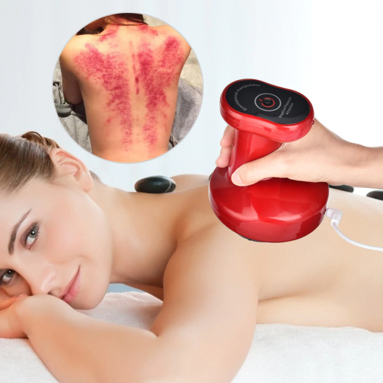Electric cupping stimulate acupoint body slimming massager guasha scraping thermal massage negative pressure acupuncture therapy 2021-09-23_5