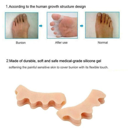 Foot Finger Corrector 1Pair s-l1600_1__38_3